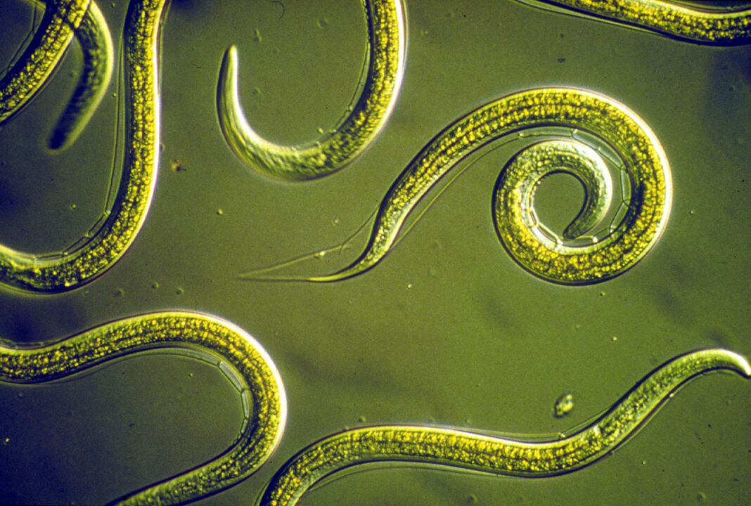 pinworm црви од човечкото тело
