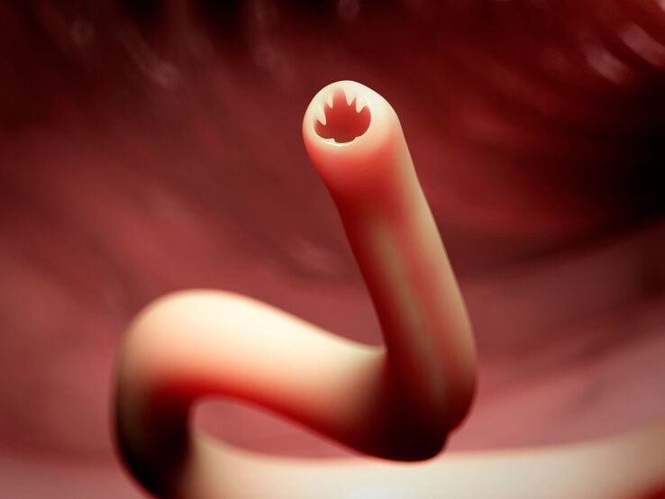 црв во внатрешноста на човечкото тело